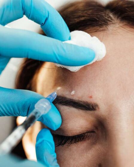 Exploring Non-Surgical Solutions for Fine Lines and Wrinkles